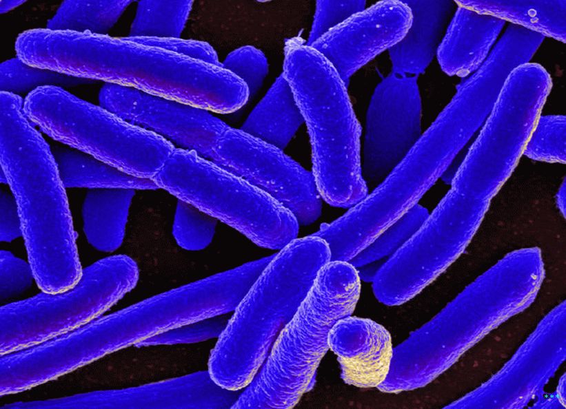 Micrografía electrónica de barrido coloreada de Escherichia coli  (E. coli), cultivada en cultivo y adherida a un cubreobjetos